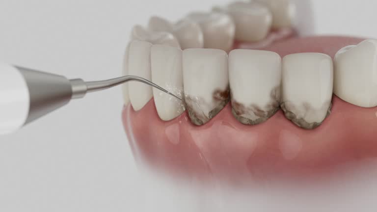 Trusted Wisdom Tooth Removal service in Juneau, AK - Dentist Open Now